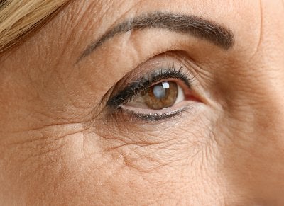 Cataract Surgeries at Gerstein Eye Institute